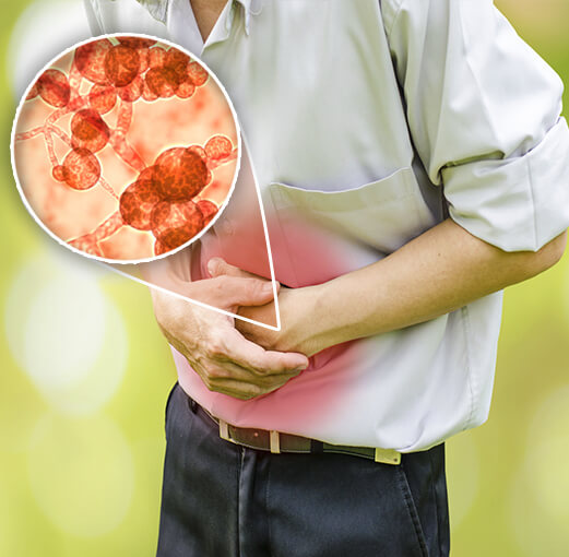 Dolor abdominal Candida
